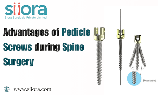 Advantages of Pedicle Screws during Spine&nbsp;Surgery