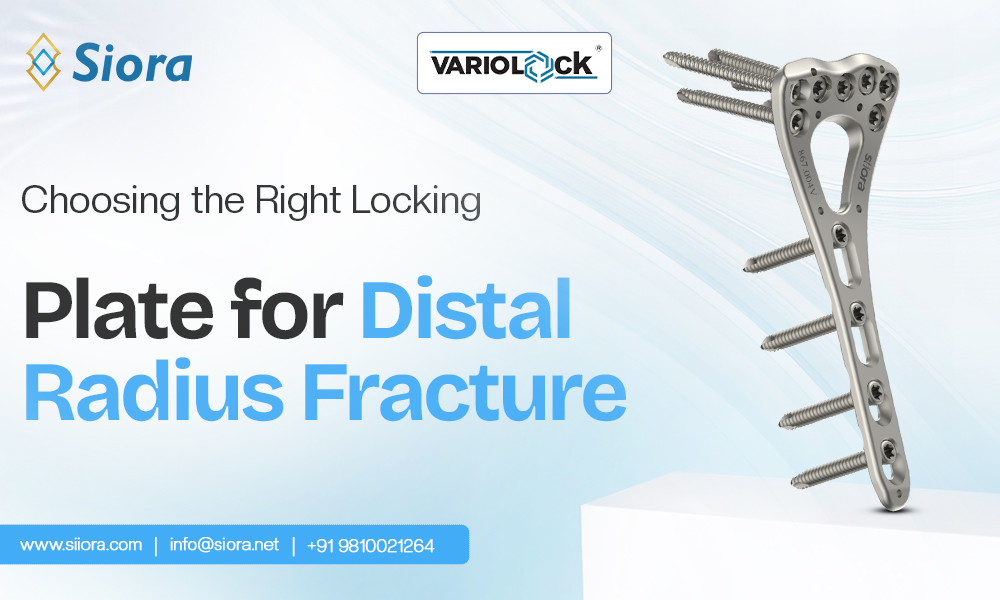 Choosing the Right Locking Plate for Distal Radius Fracture